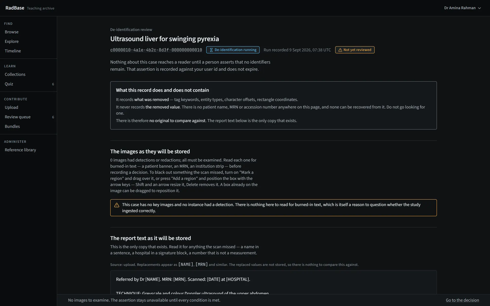 De-identification review screen showing the rewritten report with placeholders where identifiers were