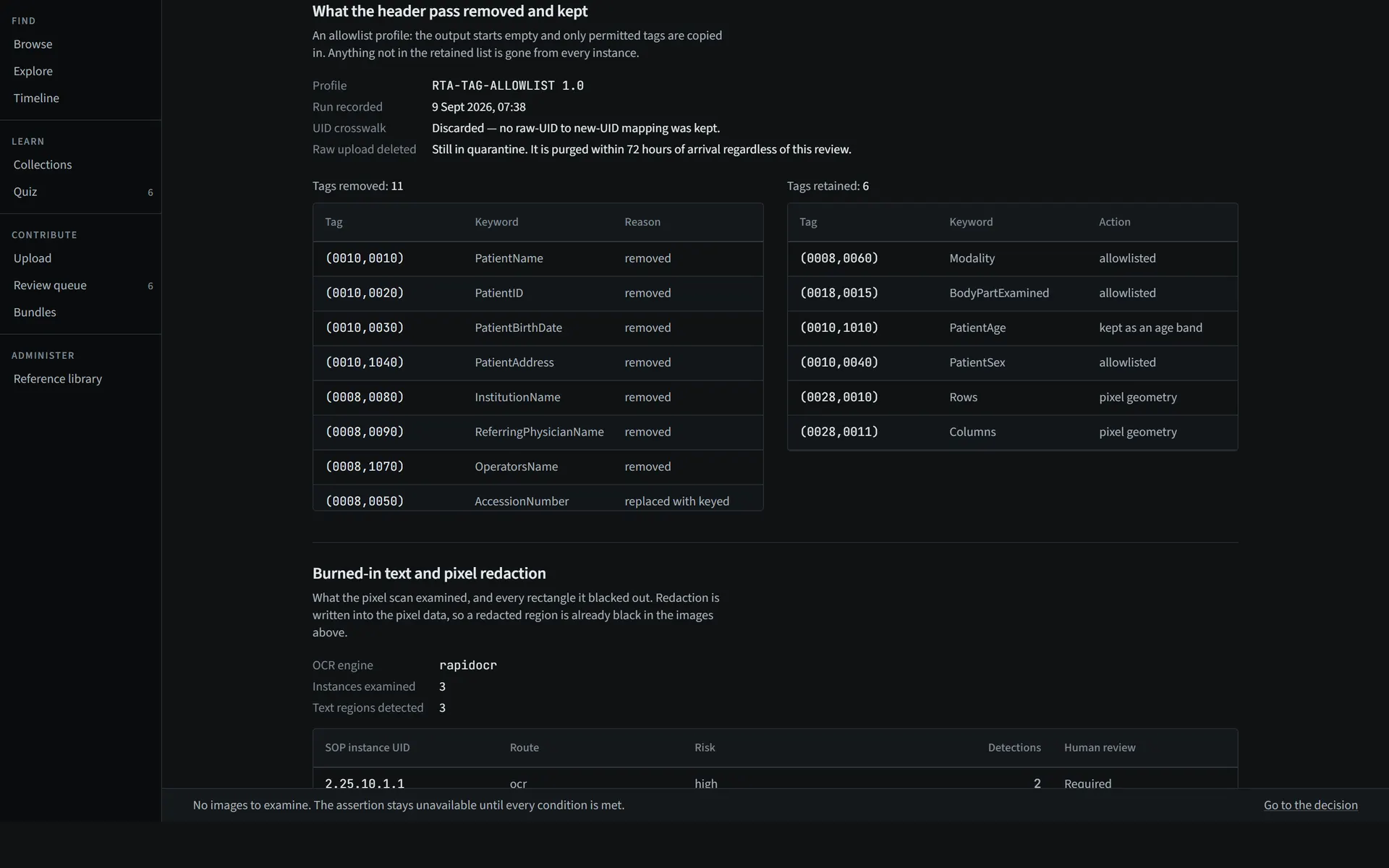 Tables of DICOM tags removed or replaced and tags retained, with the reason for each