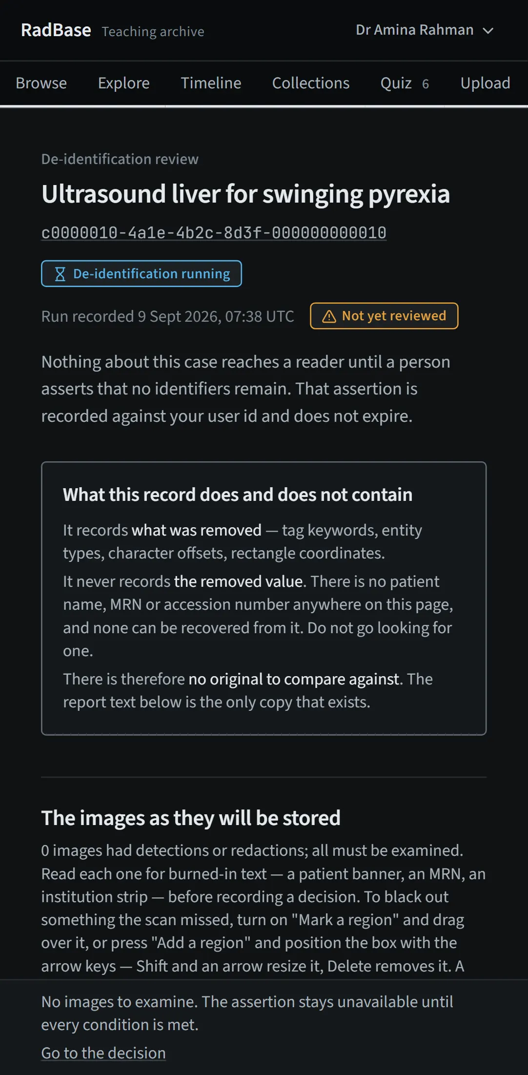 De-identification review on a phone with the same gate statement as desktop